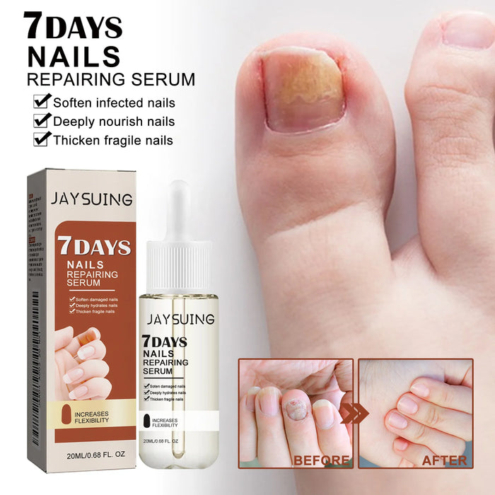 Uñas 7 Days Nail Growth Serum Nourishing Strength Care Essence Repairing Damaged Onychocryptosis Growth Nail Treatment Liquid