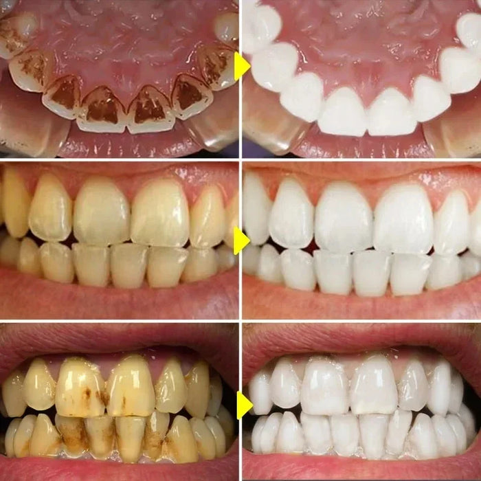 Cleaning Tooth Whitening Serum Toothpaste Effective Remove Plaque Serum Yellow Teeth Tooth Stains Removal Serum Fresh Breath