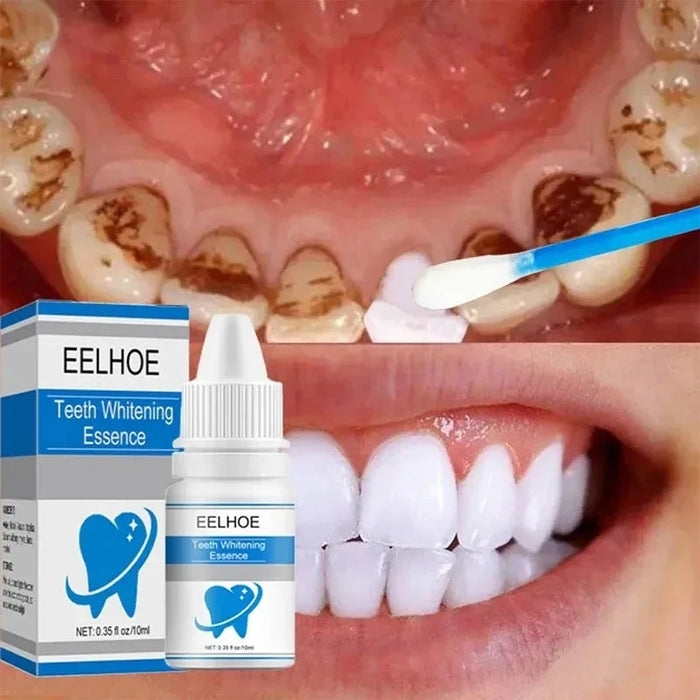 Cleaning Tooth Whitening Serum Toothpaste Effective Remove Plaque Serum Yellow Teeth Tooth Stains Removal Serum Fresh Breath