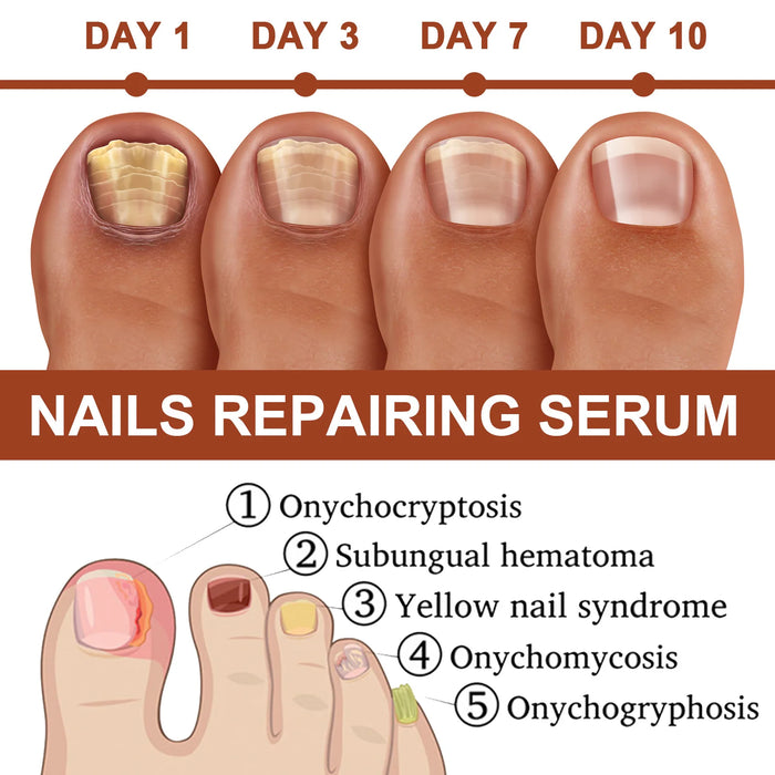 Uñas 7 Days Nail Growth Serum Nourishing Strength Care Essence Repairing Damaged Onychocryptosis Growth Nail Treatment Liquid