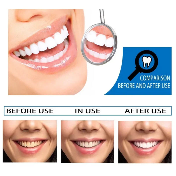 Cleaning Tooth Whitening Serum Toothpaste Effective Remove Plaque Serum Yellow Teeth Tooth Stains Removal Serum Fresh Breath