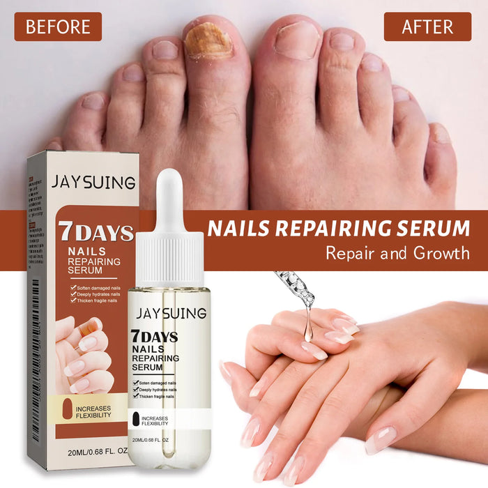 Uñas 7 Days Nail Growth Serum Nourishing Strength Care Essence Repairing Damaged Onychocryptosis Growth Nail Treatment Liquid