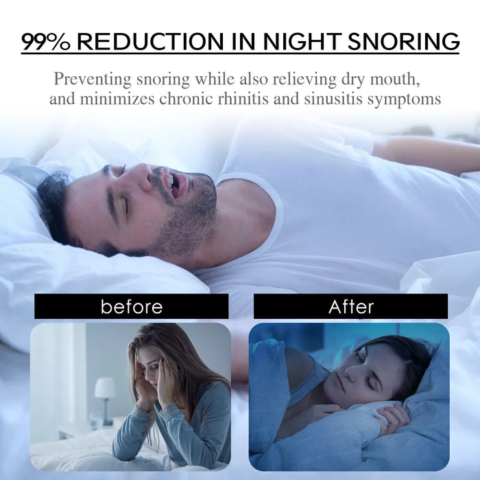 EELHOE Anti Snoring Patch Improve Sleeping Promoting Better Breath Portable Night Sleep Stop Snoring Sticker Mouth Orthosis Tape