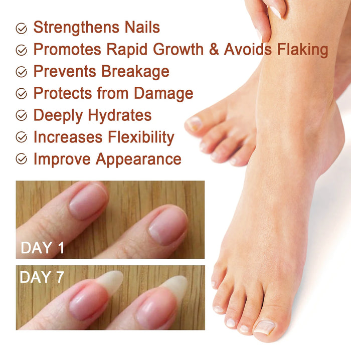 Uñas 7 Days Nail Growth Serum Nourishing Strength Care Essence Repairing Damaged Onychocryptosis Growth Nail Treatment Liquid